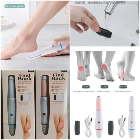 Electric Foot Callus Remover Powe source / Cell both Foot File Callus Remover Dead Skin Remover